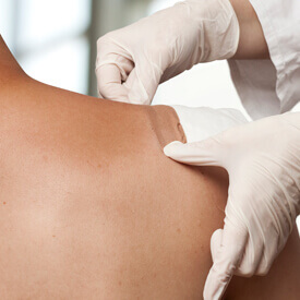 Lump and Bump Removal